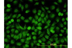 Immunofluorescence of monoclonal antibody to MAPK9 on HeLa cell. (JNK2 Antikörper  (AA 321-424))