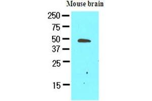 The extracts of mouse brain (50ug) were resolved by SDS-PAGE, transferred to NC membrane and probed with anti-human GAS7 (1:500). (GAS7 Antikörper)