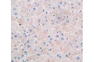 Used in DAB staining on fromalin fixed paraffin- embedded Kidney tissue (CCL26 Antikörper  (AA 24-94))