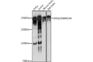 Western blot analysis of extracts of various cell lines, using BRG1/SM antibody (ABIN7270655) at 1:1000 dilution. (SMARCA4 Antikörper)