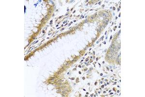 Immunohistochemistry of paraffin-embedded human stomach using TMEM189 antibody at dilution of 1:100 (40x lens). (TMEM189 Antikörper)
