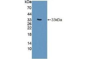 Detection of Recombinant PLCb2, Human using Polyclonal Antibody to Phospholipase C Beta 2 (PLCb2) (Phospholipase C beta 2 Antikörper  (AA 1-250))
