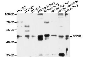Western blot analysis of extracts of various cells, using SNX6 antibody. (SNX6 Antikörper)