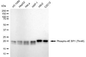 Western blotting analysis using phospho-4E BP1 (Thr46) antibody (ABIN7798530). (Rekombinanter eIF4EBP1 Antikörper  (pThr46))