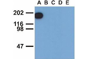 Western blotting analysis of EGFR (phospho-Tyr1173) by mouse monoclonal antibody EM-13 inEGF-treated A431 (A), CALU-3 (B), MCF-7 (C), Jurkat (D) and Ramos (E) cell lines (reduced conditions). (EGFR Antikörper  (Tyr1173))