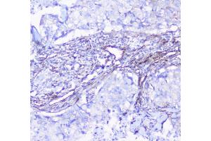 IHC analysis of INPPL1 using anti-INPPL1 antibody (ABIN6719492).