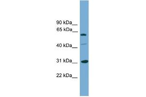 WB Suggested Anti-RAD1 Antibody Titration: 0. (RAD1 Antikörper  (Middle Region))