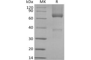 Western Blotting (WB) image for Glypican 3 (GPC3) protein (His tag) (ABIN7321025) (Glypican 3 Protein (GPC3) (His tag))