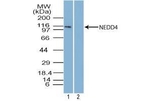 Image no. 1 for anti-Neural Precursor Cell Expressed, Developmentally Down-Regulated 4, E3 Ubiquitin Protein Ligase (NEDD4) (AA 950-1000) antibody (ABIN960275) (NEDD4 Antikörper  (AA 950-1000))