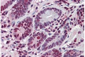 Human Small Intestine: Formalin-Fixed, Paraffin-Embedded (FFPE)