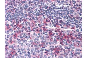 Immunohistochemical analysis of paraffin-embedded human Tonsil tissues using anti-CD69 mouse mAb (CD69 Antikörper)