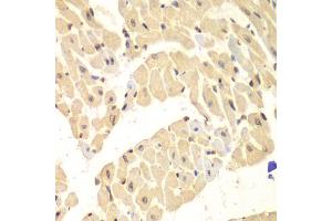 Immunohistochemistry of paraffin-embedded mouse heart using HIF1AN antibody (ABIN5973179) at dilution of 1/100 (40x lens). (HIF1AN Antikörper)