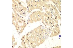Immunohistochemistry of paraffin-embedded mouse heart using HIF1AN antibody (ABIN5973179) at dilution of 1/100 (40x lens).
