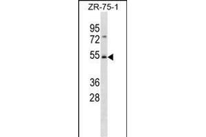 FBXW4 Antibody (C-term) (ABIN1881340 and ABIN2839057) western blot analysis in ZR-75-1 cell line lysates (35 μg/lane).