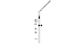Anti-Myc Tag Antibody at 1:2000 dilution + 12 tag recombinant protein lysate Lysates/proteins at 20 μg per lane. (Myc Tag Antikörper)