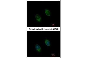 ICC/IF Image Immunofluorescence analysis of methanol-fixed HeLa, using BMP4, antibody at 1:100 dilution. (BMP4 Antikörper)