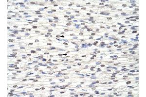 RBM8A antibody was used for immunohistochemistry at a concentration of 4-8 ug/ml to stain Myocardial cells (arrows) in Human Heart.