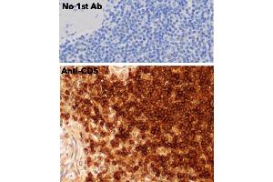 Immunohistochemistry (IHC) image for anti-CD5 (CD5) (AA 105-210) antibody (ABIN7272988) (CD5 Antikörper  (AA 105-210))