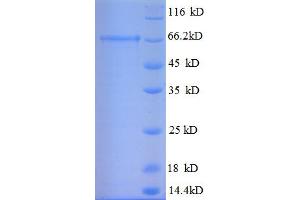 SDS-PAGE (SDS) image for Glutamate Decarboxylase 2 (Pancreatic Islets and Brain, 65kDa) (GAD2) (AA 1-585), (full length) protein (His tag) (ABIN5709545) (GAD65 Protein (AA 1-585, full length) (His tag))
