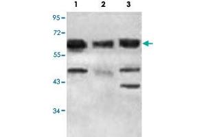 Western blot analysis of 293T (Lane 1), K-562 cells (Lane 2) and fetal heart tissue lysate with ACAD9 polyclonal antibody  at 1 : 500 dilution. (ACAD9 Antikörper  (AA 1464-1642))