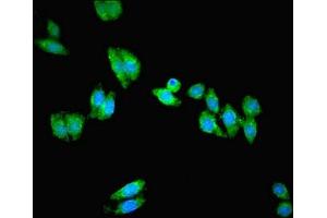 Immunofluorescent analysis of HepG2 cells using ABIN7162599 at dilution of 1:100 and Alexa Fluor 488-congugated AffiniPure Goat Anti-Rabbit IgG(H+L) (PANK1 Antikörper  (AA 462-582))