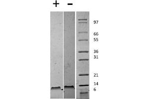SDS-PAGE of Mouse Stromal Cell-Derived Factor-1 beta (CXCL12) Recombinant Protein SDS-PAGE of Mouse Stromal Cell-Derived Factor-1 beta (CXCL12) Recombinant Protein. (SDF1 beta Protein)