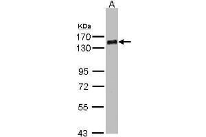 WB Image Sample(30 ug whole cell lysate) A:MOLT4 , 7. (PHF20 Antikörper  (N-Term))