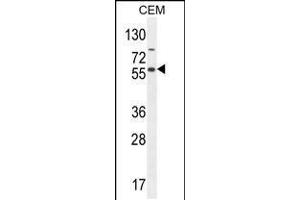 Western blot analysis in CEM cell line lysates (35ug/lane). (NFKBIL1 Antikörper  (AA 256-285))
