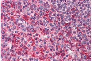 Human Spleen (formalin-fixed, paraffin-embedded) stained with PAK4 antibody ABIN214461 at 2. (PAK4 Antikörper  (Internal Region))