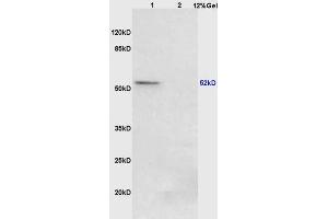 Lane 1: mouse lung lysates Lane 2: mouse stomach lysates probed with Anti Phospho-PPAR Gamma (ser273) Polyclonal Antibody, Unconjugated (ABIN734663) at 1:200 in 4 °C.