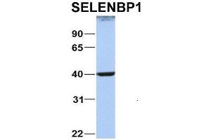 Host:  Rabbit  Target Name:  NOP56  Sample Type:  MCF7  Antibody Dilution:  1. (SELENBP1 Antikörper  (C-Term))