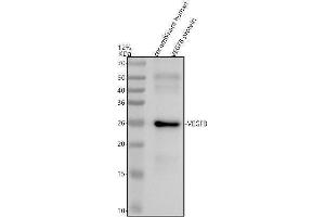 Western blot analysis of VEGFB using anti-VEGFB antibody (ABIN7606688).
