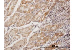 Immunohistochemistry (Formalin-fixed Paraffin-embedded Sections) (IHC (fp)) image for anti-metallophosphoesterase Domain Containing 1 (MPPED1) (AA 1-326) antibody (ABIN513909)