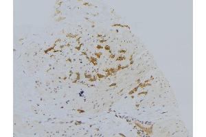 ABIN6273025 at 1/100 staining Human lung tissue by IHC-P. (VPS33B Antikörper)