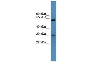 WB Suggested Anti-TP53RK Antibody Titration: 0. (TP53RK Antikörper  (N-Term))