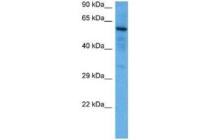 Host:  Rabbit  Target Name:  SOX9  Sample Tissue:  Mouse Brain  Antibody Dilution:  1ug/ml