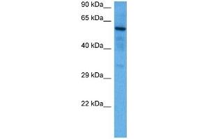 Host:  Rabbit  Target Name:  SOX9  Sample Tissue:  Mouse Brain  Antibody Dilution:  1ug/ml (SOX9 Antikörper  (N-Term))