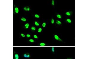 Immunofluorescence analysis of HepG2 cells using FCGR2A Polyclonal Antibody (FCGR2A Antikörper)