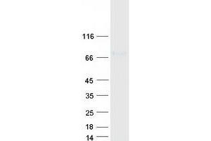 Western Blotting (WB) image for Coagulation Factor XI (F11) protein (Myc-DYKDDDDK Tag) (ABIN2712928)