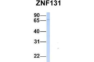 Host:  Rabbit  Target Name:  ZNF131  Sample Type:  Jurkat  Antibody Dilution:  1.