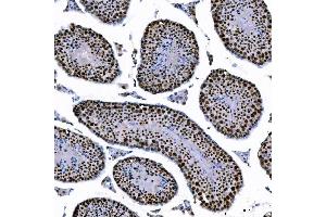 IHC analysis of SAE1 using anti-SAE1 antibody (ABIN7601346). (SAE1 Antikörper  (AA 33-299))
