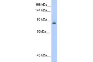 Western Blotting (WB) image for anti-Aconitase 1 (ACO1) antibody (ABIN2462120) (Aconitase 1 Antikörper)