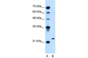 WB Suggested Anti-IGLL1  Antibody Titration: 5. (IGLL1 Antikörper  (N-Term))