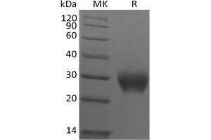 Western Blotting (WB) image for Leukocyte-Associated Immunoglobulin-Like Receptor 1 (LAIR1) protein (His tag) (ABIN7321031)