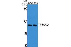 Western Blot (WB) analysis of specific cells using DRAK2 Polyclonal Antibody. (DRAK2 Antikörper  (Internal Region))