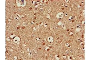 Immunohistochemistry of paraffin-embedded human brain tissue using ABIN7145099 at dilution of 1:100 (ATG13 Antikörper  (AA 315-517))