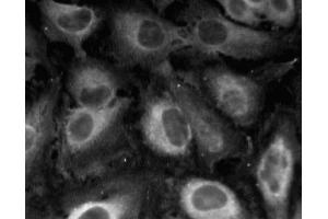 Immunofluorescent staining of HeLa (ATCC CCL-2) cells.