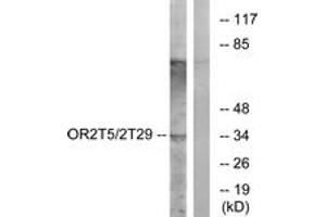 Western blot analysis of extracts from K562 cells, using OR2T5/2T29 Antibody. (OR2T5/2T29 Antikörper  (AA 66-115))