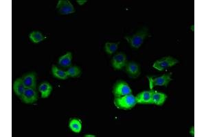 Immunofluorescent analysis of A431 cells using ABIN7164023 at dilution of 1:100 and Alexa Fluor 488-congugated AffiniPure Goat Anti-Rabbit IgG(H+L) (ATP12A Antikörper  (AA 171-306))