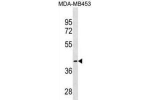 Western Blotting (WB) image for anti-Cysteine-S-conjugate beta-Lyase (CCBL1) antibody (ABIN3000294) (CCBL1 Antikörper)